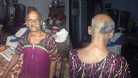 ಅರ್ಧ ತಲೆಬೋಳಿಸಿಕೊಂಡು ಪ್ರತಿಭಟಿಸಿದ ವ್ಯಕ್ತಿ