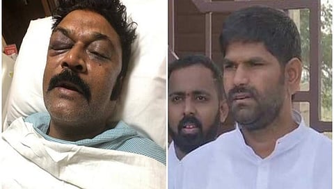 ಆನಂದ್ ಸಿಂಗ್ ಮೇಲೆ ಹಲ್ಲೆ: ಕಂಪ್ಲಿ ಶಾಸಕರ ಪತ್ತೆಗೆ ಮೂರು ಪೋಲೀಸ್ ತಂಡ ರಚನೆ
