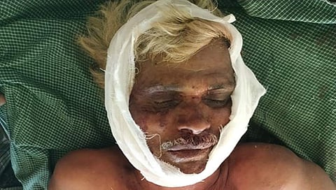 ಆನೆ ದಾಳಿಯಿಂದ ಗಾಯಗೊಂಡ ವ್ಯಕ್ತಿ. ಚಿತ್ರ: ಎಸ್.ಉದಯಶಂಕರ್