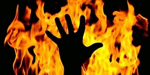 Bengaluru: man torches lover and her parents over scooter dispute (file photo)