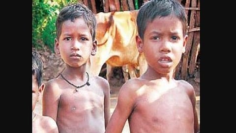 ಅಪೌಷ್ಟಿಕ ಮಕ್ಕಳು