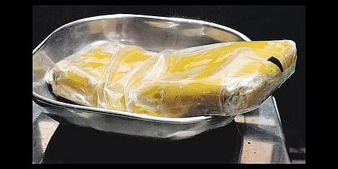 ಚಿನ್ನದ ಮೊಬೈಲ್ ಕವರ್