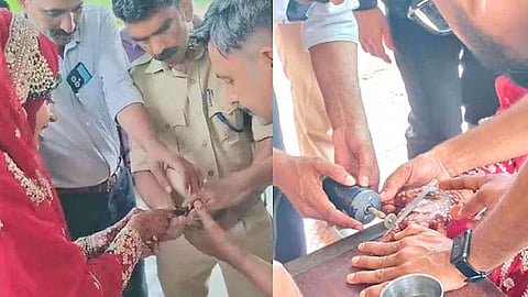 கேரளத்தில் விரலில் மோதிரம் சிக்கி தவித்த மணப்பெண் - தீயணைப்பு வீரர்கள் வெட்டி அகற்றினர்