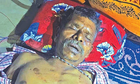 யானை மிதித்து பலியான காலன்.