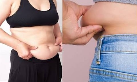 BellyFatLoss 