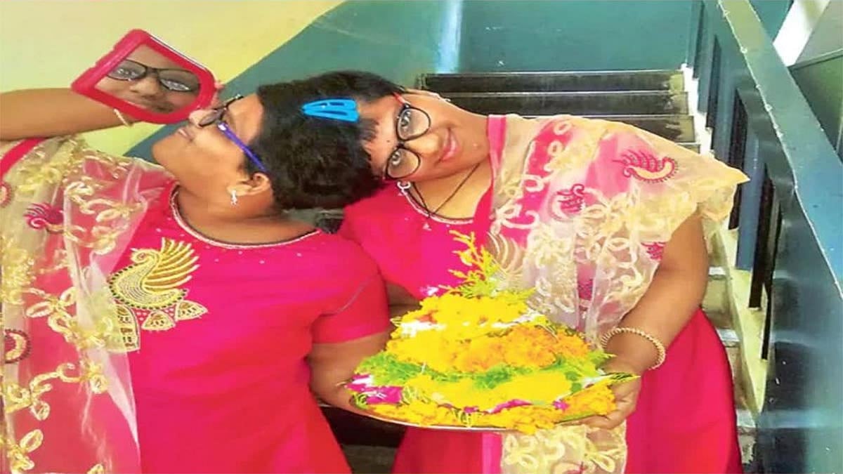 ஐதராபாத்தில் தலை ஒட்டி பிறந்த சகோதரிகள் வங்கி தேர்வு எழுதுவதில் சிக்கல்