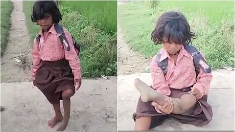 Ragini Disabled Girl