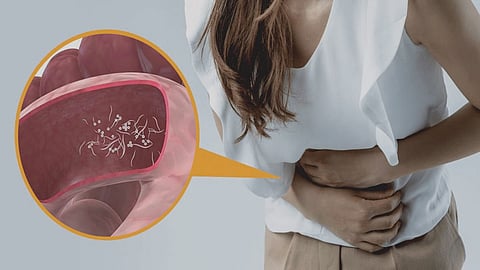 Intestinal worms 