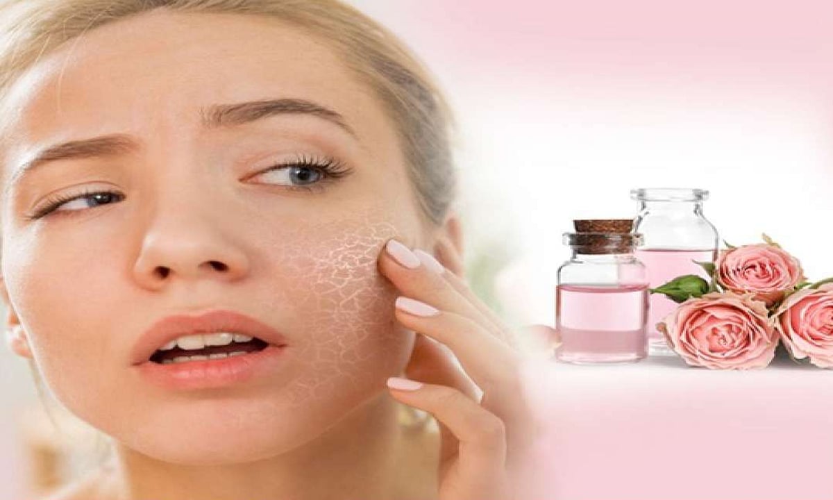 HOME REMEDY ROSE WATER 