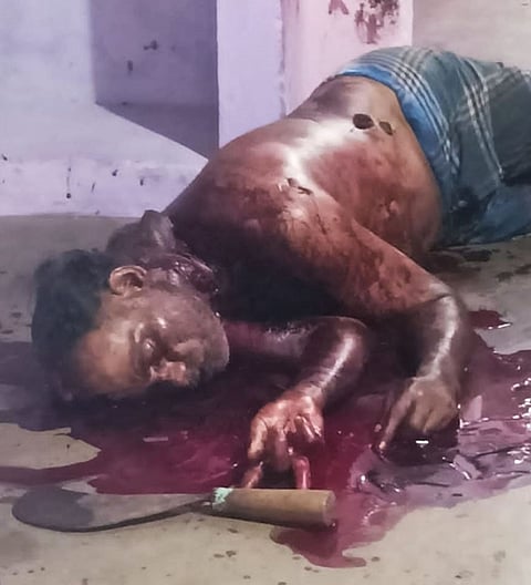 என்.எல்.சி. தொழிலாளி பிணமாக கிடக்கும் காட்சி.&nbsp;