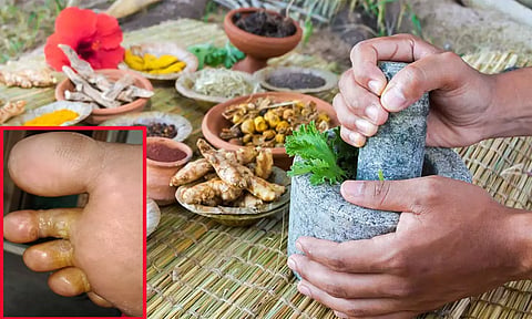 கால் விரல் இடுக்குகளில் வரும் சேற்றுப்புண்... தீர்வு தரும் சித்த மருத்துவம்...