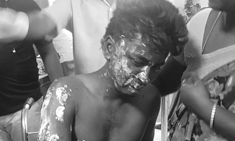 வெங்கல் அருகே இறுதி ஊர்வலத்தில் பட்டாசு வெடித்து விபத்து: 6 பேர் படுகாயம்