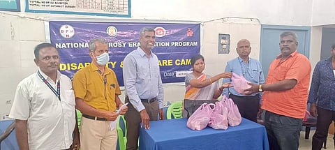 தொழுநோய் ஊனம் தடுப்பு முகாம்