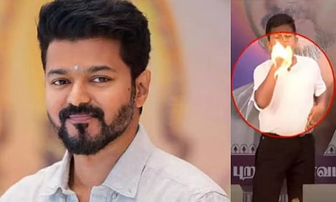 விஜய் பிறந்தநாள் - சாகசம் செய்ய முயன்ற சிறுவன் கையில் தீ