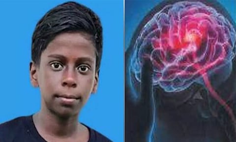 கேரளாவில் அமீபிக் மூளைக்காய்ச்சலுக்கு மேலும் ஒரு மாணவன் உயிரிழப்பு