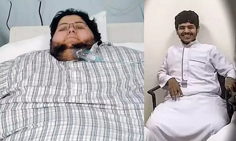 weight loss
