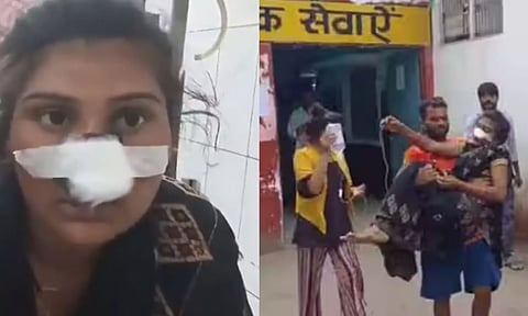 பிறந்த வீட்டுக்கு போக அடம்பிடித்த மனைவியின் மூக்கை அறுத்த கணவன்