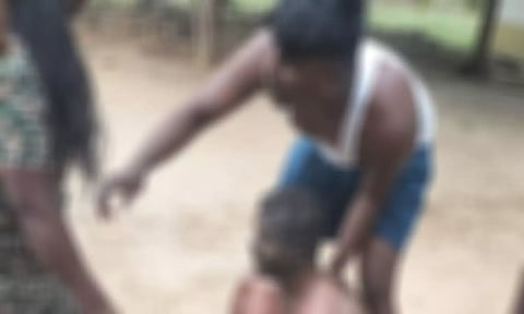 ஊரை விட்டு ஒதுக்கி வைத்ததால்- தீக்குளிக்க முயன்ற மாற்றுத்திறனாளிக்கு ஆஸ்பத்திரியில் சிகிச்சை