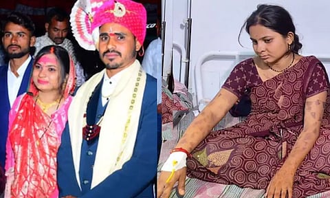 வரதட்சணை கொண்டு வராத மனைவியை கட்டிவைத்து  கொதிக்கும் கத்தியால் வாயில் சூடு போட்ட கொடூர கணவன்