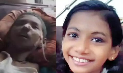 கார் மோதி விபத்து- கோமா நிலைக்கு சென்ற சிறுமியின் குடும்பத்துக்கு ரூ1.15 கோடி இழப்பீடு