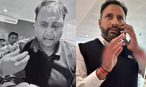 டெல்லி விமான நிலையத்தில் பயணியை ரத்தம் பீறிட சரமாரியாக தாக்கிய ஏர் இந்தியா விமானி!