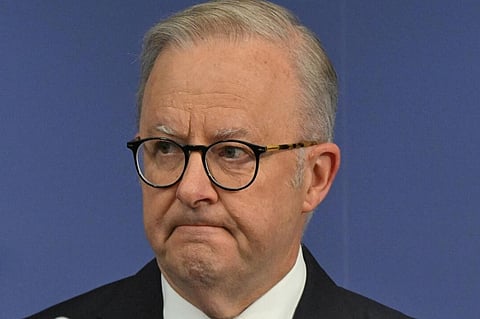  Prime Minister Anthony Albanese