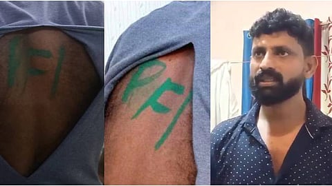 കൊല്ലത്ത് സൈനികന്‍റെ ശരീരത്തിൽ ചാപ്പകുത്തിയെന്ന പരാതി വ്യാജം; ഉപയോഗിച്ച പെയിന്‍റും ബ്രഷും കണ്ടെടുത്തു