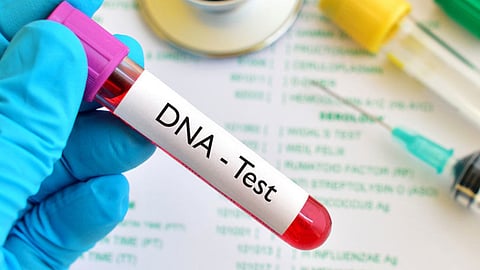 DNA test, representative image
