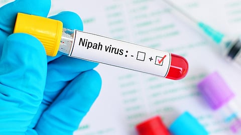 another case of nipah death reported in palakkad