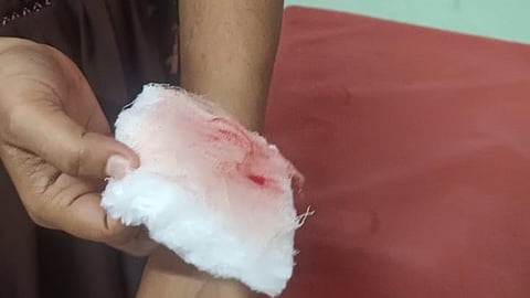 Woman injured in monkey attack at Athirappilly