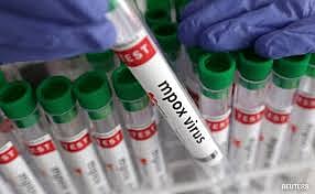 mpox result negative at kannur