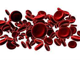 sickle cell anemeia