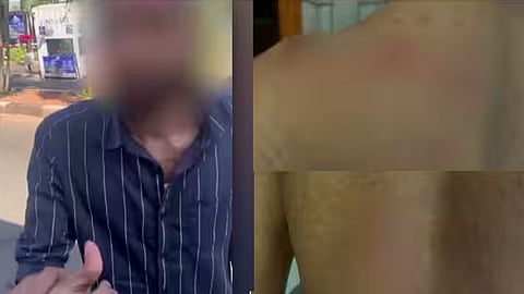 Argument over parking fee; Umrah pilgrim brutally beaten at Karipur airport