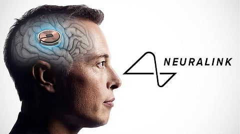 brain device 
