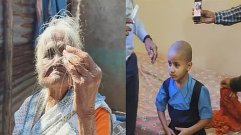 maharashtra mass hair loss solved medical expert report