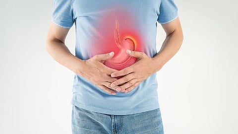 Ulcers can be prevented through a healthy diet; endoscopy is recommended for diagnosis