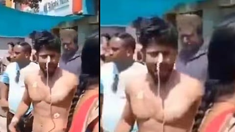 man said to be in coma walks out of icu scam in madhya pradesh