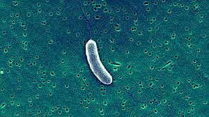 Fisherman's foot eaten by flesh-eating bacteria