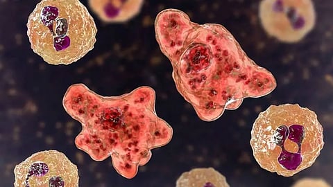 Amebic encephalitis: Siblings of deceased 9-year-old girl tested negative 