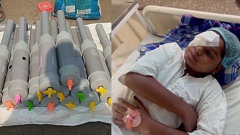 carbide gun diwali celebration, 14 kids lost eyesight