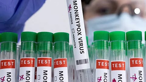 m pox reported thiruvananthapuram