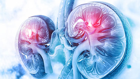 Kidney cancer doctor opinion