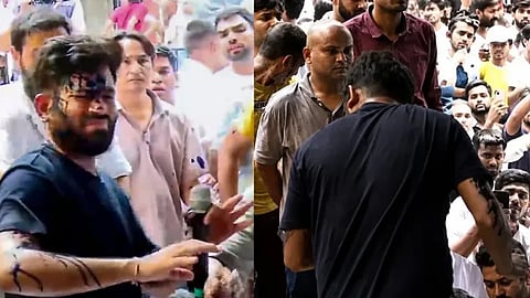 Woman hurls ink like liquid at Abhijeet Dipke at Jantar Mantar