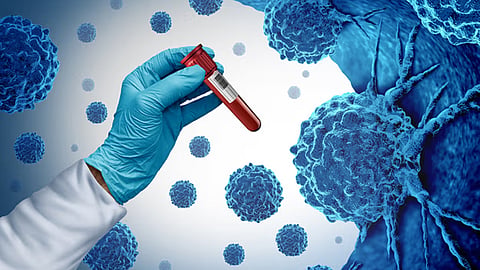 Cancer on the rise; WHO predicts number of patients will double within 25 years