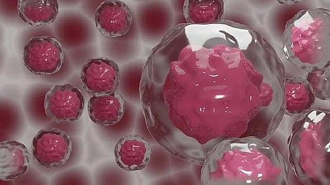 Anastrozole, a licensed risk-reducing drug for breast cancer prevention