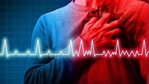Heart attack