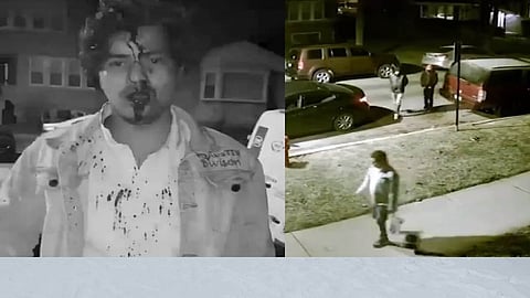 Indian IT student brutally attacked in Chicago