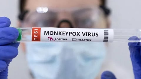 Another Mpox case reported in Kerala