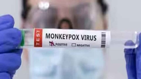 MPox virus strain