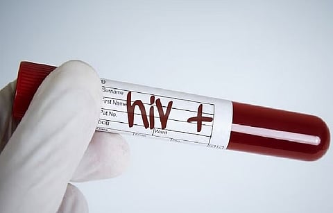 HIV test